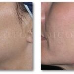 ¡Elimina manchas difíciles de la ropa de forma sencilla y efectiva!